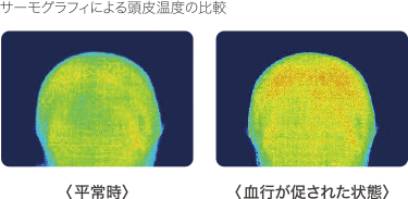 我們專注於脫髮和生長信號。 安排您的頭髮週期，使其健康且不受干擾。